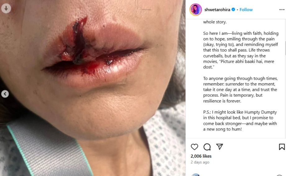 सलमान खान की राखी बहन और पुलकित सम्राट की पूर्व पत्नी श्वेता रोहिरा की भयानक सड़क दुर्घटना हुई; विवरण जांचें 55429